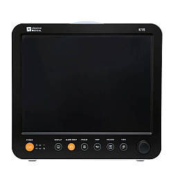 Приліжковий монітор пацієнта з сенсорним екраном і ETCO2" 15 K1, Creative Medical , (003136)