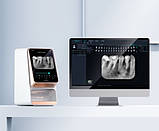 Сканер фосфорних пластин  Woodpecker, i-Scan 4K, фото 3