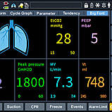 Апарат ШВЛ Т6 Advanced Model Amoul, фото 6