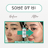 Очищуючий кислотний тонер Some By Mi AHA-BHA-PHA 30 Days Miracle Toner 150 мл, фото 3