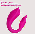 Вібратор для пари U-подібної форми вакуумний стимулятор Wo-sex U1020. 10 режимів, фото 3