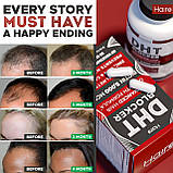 Блокатор ДГТ (DHT дигідротестостерон) Hairo Nutrition проти випадіння волосся в жінок і чоловіків, фото 3