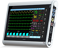 Монитор пациента ЮМ 300-15
