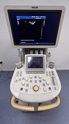 Ультразвукова система Philips IU22, фото 4