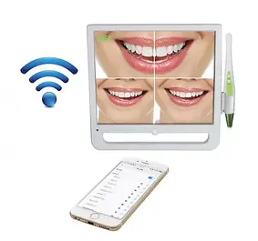 Камери інтраоральні