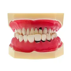 Модель демонстраційна пародонтологічна HST-L3