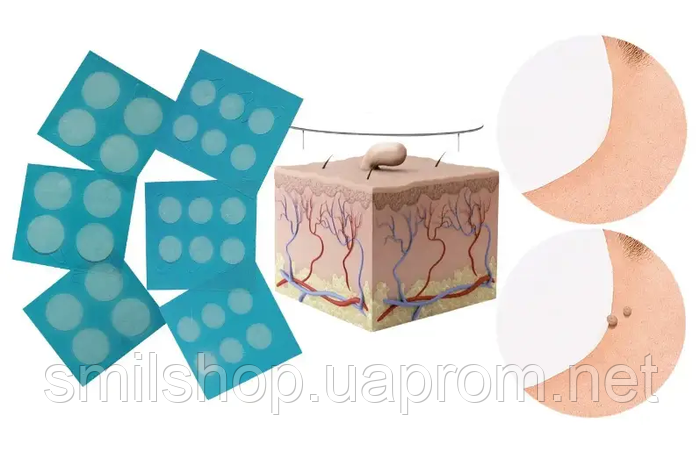 Купить Пластырь от Папиллом и Бородавок Formu Clear Tag Patch, цена 180 ...