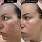 The Inkey List 1% Retinol Scar, Mark and Wrinkle Solution омолоджуюча сироватка з 1% ретинолом, фото 4