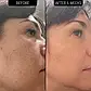 The Inkey List 1% Retinol Scar, Mark and Wrinkle Solution омолоджуюча сироватка з 1% ретинолом, фото 5