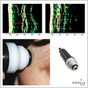 УЗД-сканер для шкіри, DermaLab Combo