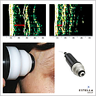 УЗД-сканер для дерматології та косметології, DermaLab USB — 10, фото 2