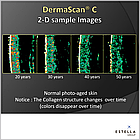 УЗД-сканер для шкіри, DermaScan C, фото 2
