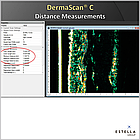 УЗД-сканер для шкіри, DermaScan C, фото 4