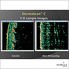 УЗД-сканер для шкіри, DermaScan C, фото 6
