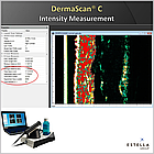 УЗД-сканер для шкіри, DermaScan C, фото 3