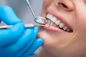 Розхідники для стоматологій