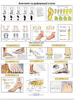 Плакат анатомии и деформации стопы 86×67см.