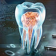 Інтер’єрна картина для стоматологічного кабінету Зуб та Інструменти, фото 6