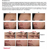 Крем для обличчя MODAY 30 мл Syn-Ake Cream Complex Peptide 6-in-1 на основі 5 видів пептиду та Syn-Ake / антивіковий ліфтинговий /, фото 2