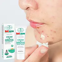 Крем от акне восстанавливающий уход за кожей лица Fade Acne Print