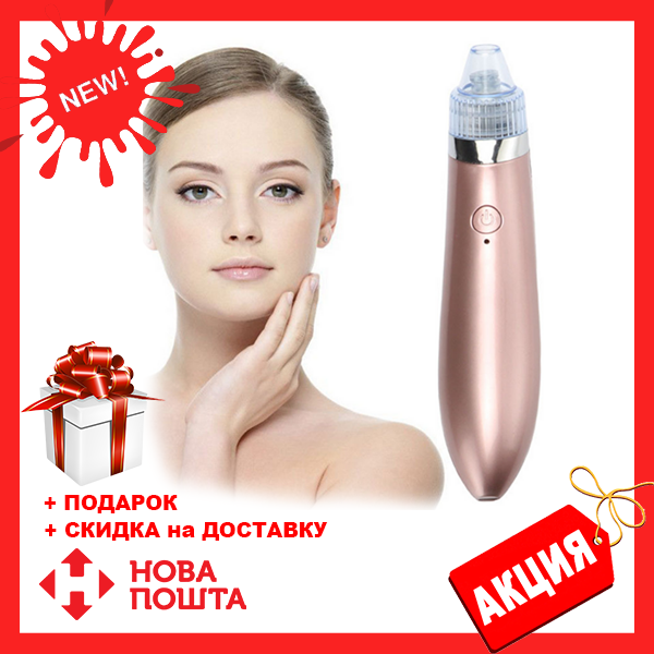 Апарат для вакуумного чищення обличчя XN-8030, вакуумний очищувач пор, чищення чорних крапок, догляд за обличчям, фото 1