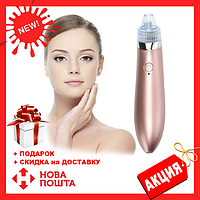 Апарат для вакуумного чищення обличчя XN-8030, вакуумний очищувач пор, чищення чорних крапок, догляд за обличчям