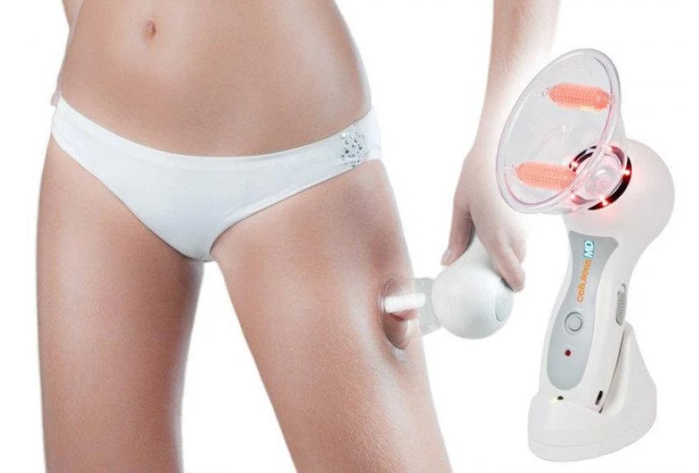Вакуумний масажер від целюліту Cellules MD, Антицелюлітний масажер, фото 1