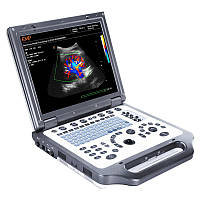 Портативный ультразвуковой сканер EMP G30