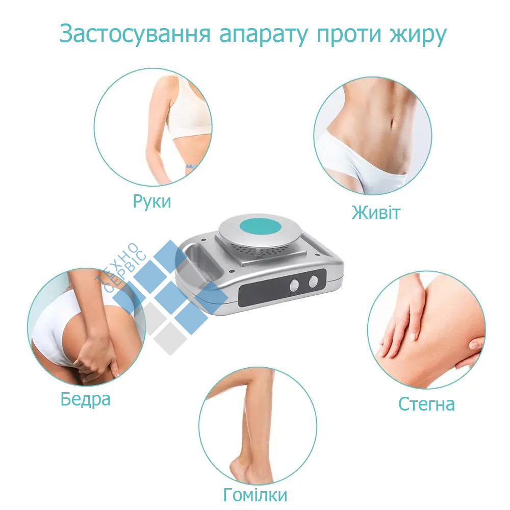 Портативный аппарат для похудения CryoPad для криолиполиза - фото 2 - id-p1464618093