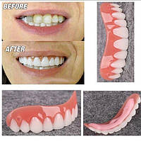 Виниры Perfect Smile Veneers, Эксклюзивный