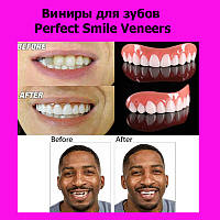 Виниры для зубов Perfect Smile Veneers, Эксклюзивный