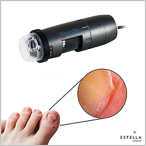 ПОДОСКОП цифровий PodoScope (MEDL4FW), Dino-lite
