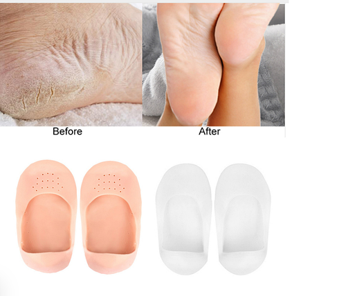 Силіконові шкарпетки зволожуючі шкарпетки проти тертя стопи ANTI-CRACK SILICONE SOCKS, фото 1