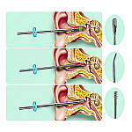 Інструменти для чищення вух Lanbena (6 шт) у шкіряному тубусі рожевий, фото 2