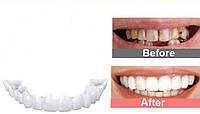 Съемные виниры на НИЖНЮЮ челюсть Snap On Smile Veneers