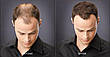 Загусник для волосся Toppik Hair Building Fibers Black, фото 9