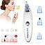 Апарат для очищення шкіри обличчя Derma Suction / Вакуумний очищувач чорних крапок / Апарат для чищення пор, фото 9