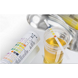 Тест-смужки Діагностичні для аналізу сечі GLANBER 11 показників 100 шт, фото 2