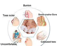 Разделитель для пальцев ног, фиксатор вальгус силиконовый