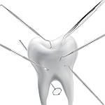 НАБОРЫИ ДЛЯ РЕСТАВРАЦІЇ, ГЛАДИЛКИ, ПАКЕРИ, РАПТОРИ