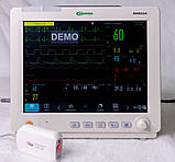 Монітор пацієнта ВМ800А з сенсорним дисплеєм + CO2 (капнографія masimo), фото 6