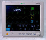 Монітор пацієнта ВМ800А з сенсорним дисплеєм + CO2 (капнографія masimo), фото 8