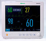 Монітор пацієнта ВМ800А з сенсорним дисплеєм + CO2 (капнографія masimo), фото 9