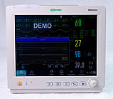Монітор пацієнта ВМ800А з сенсорним дисплеєм, фото 8