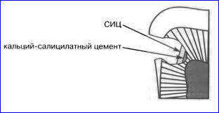 Прокладочні матеріали лікувальні та ізолюючі