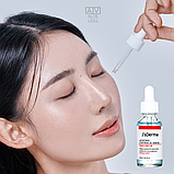 Заспокійлива сироватка для обличчя з ніацинамідом та цинком J’sDerma Acnetrix Control AC Serum 30 мл, фото 3