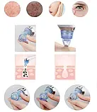 Вакуумний очисник пор Derma Suction для очищення пор обличчя зі змінними насадками 2 режими, фото 3