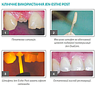 Jen-EsthePost,Джен-Есте-Пост,штифти скловолоконні 6шт/уп, №1 діам.=0.9906мм (Джендентал), фото 2