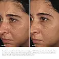 Біо-пептидний нічний крем з фитоестрогенами - Image Skincare Ormedic Balancing Bio Peptide Creme, фото 5