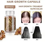 Вітамінні капсули для росту і проти випадіння волосся Sevich, фото 3